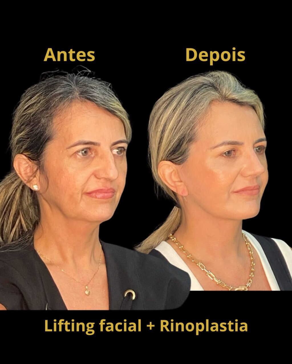 Instagram post from drglaucoalmeida. This post is in position 5.