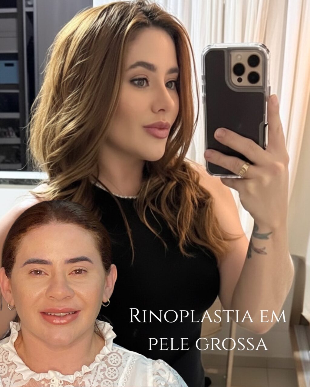 Instagram post from drglaucoalmeida. This post is in position 1.