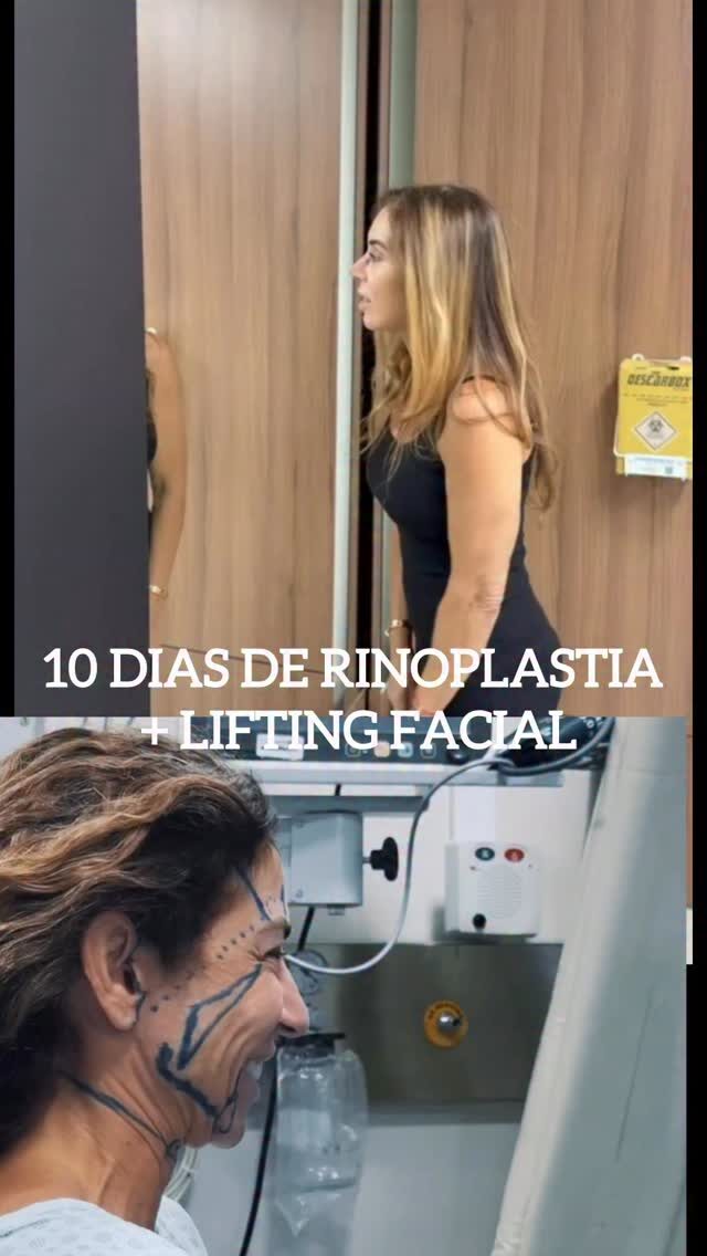 Instagram post from drglaucoalmeida. This post is in position 1.