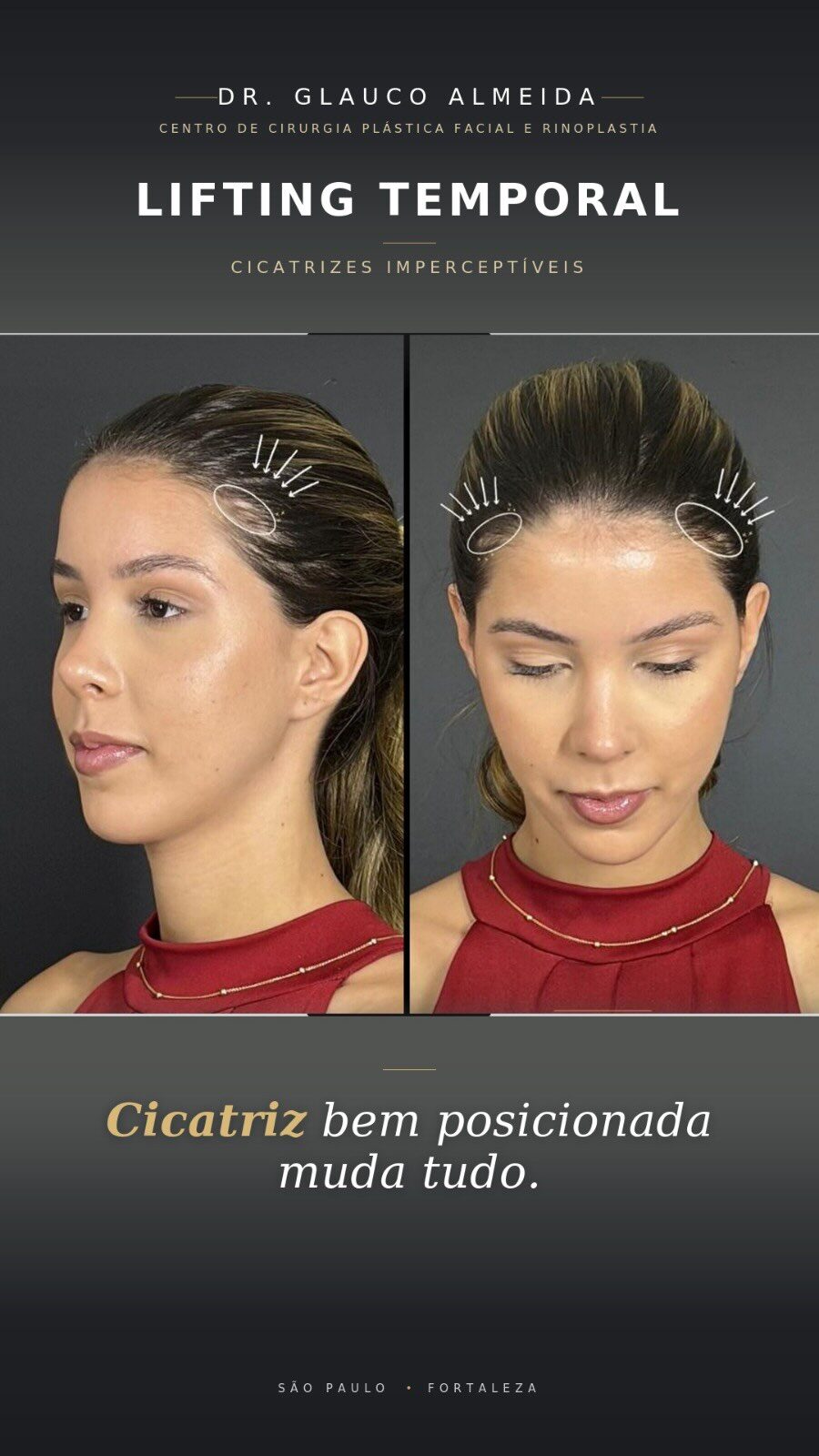 Instagram post from drglaucoalmeida. This post is in position 1.