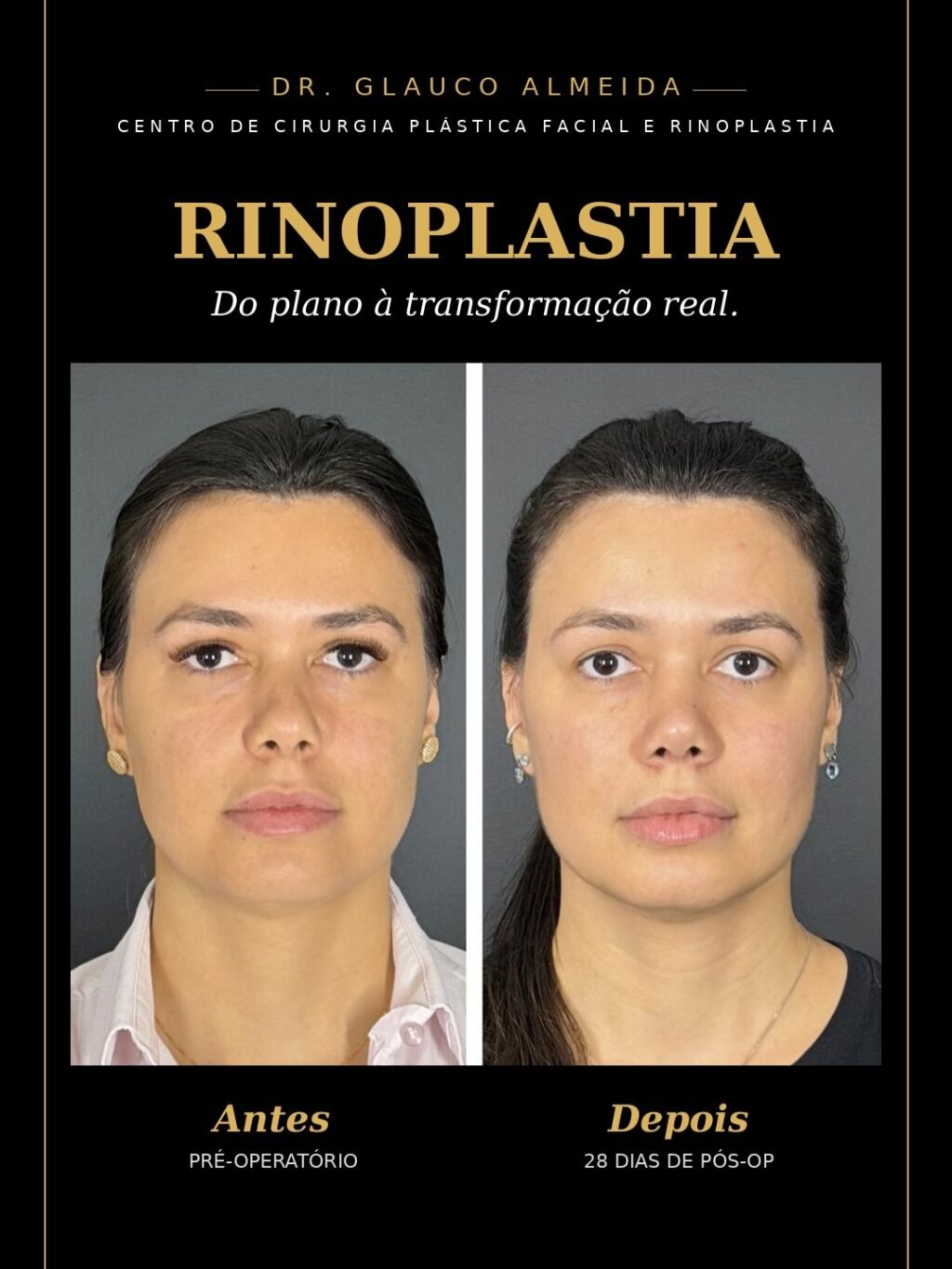 Instagram post from drglaucoalmeida. This post is in position 5.