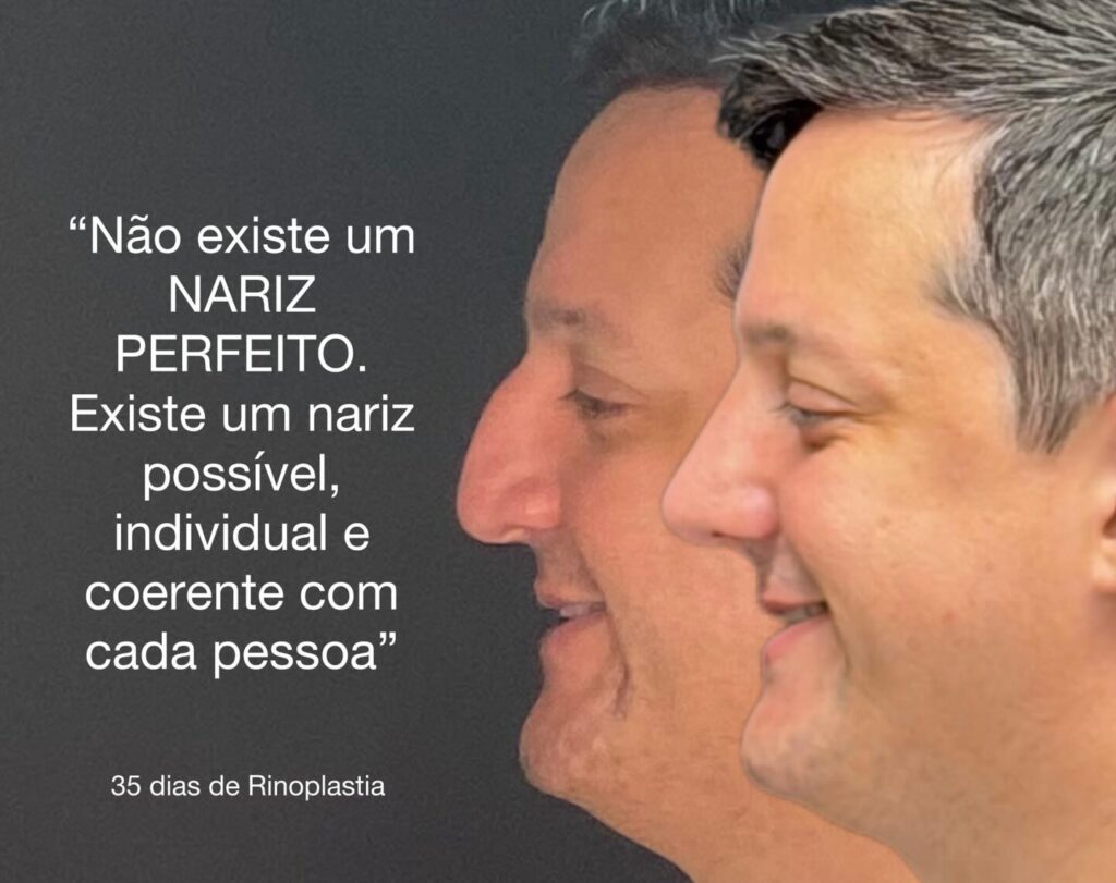 Instagram post from drglaucoalmeida. This post is in position 0.