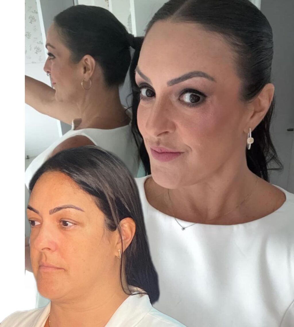 Instagram post from drglaucoalmeida. This post is in position 4.