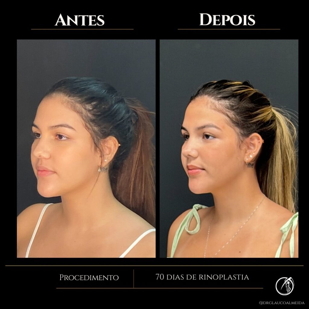 Instagram post from drglaucoalmeida. This post is in position 1.