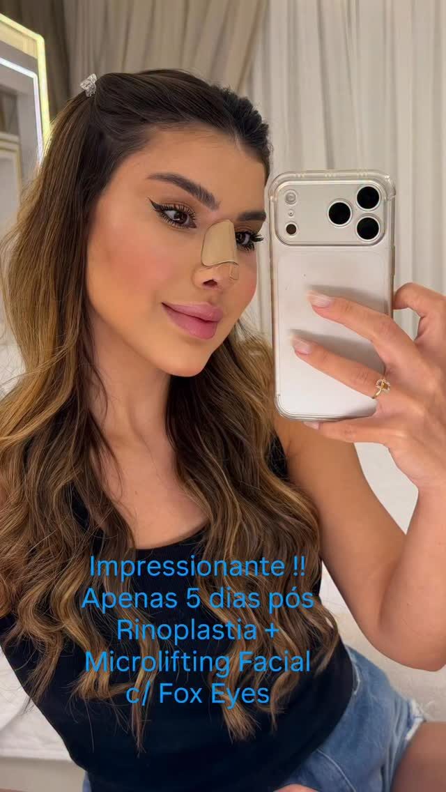 Instagram post from drglaucoalmeida. This post is in position 2.