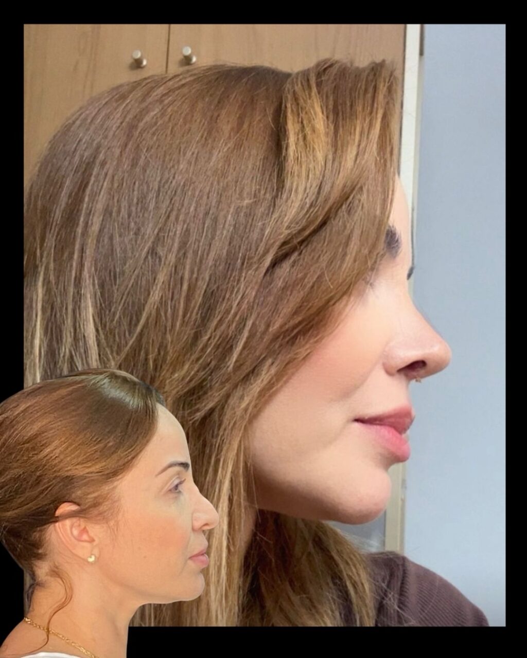 Instagram post from drglaucoalmeida. This post is in position 1.