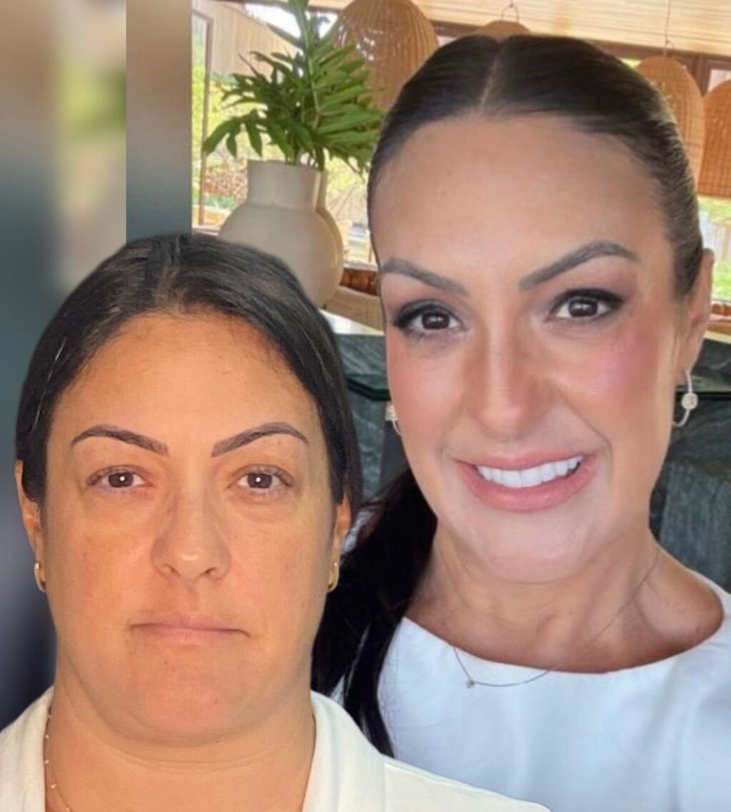 Instagram post from drglaucoalmeida. This post is in position 1.