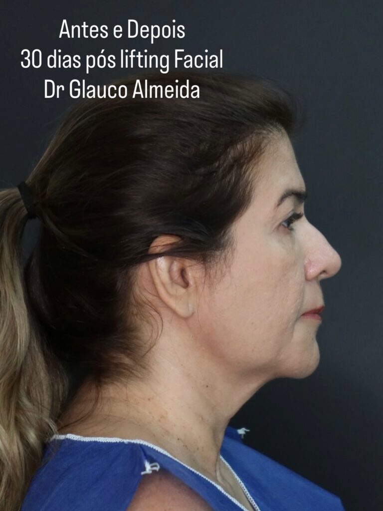 Instagram post from drglaucoalmeida. This post is in position 1.