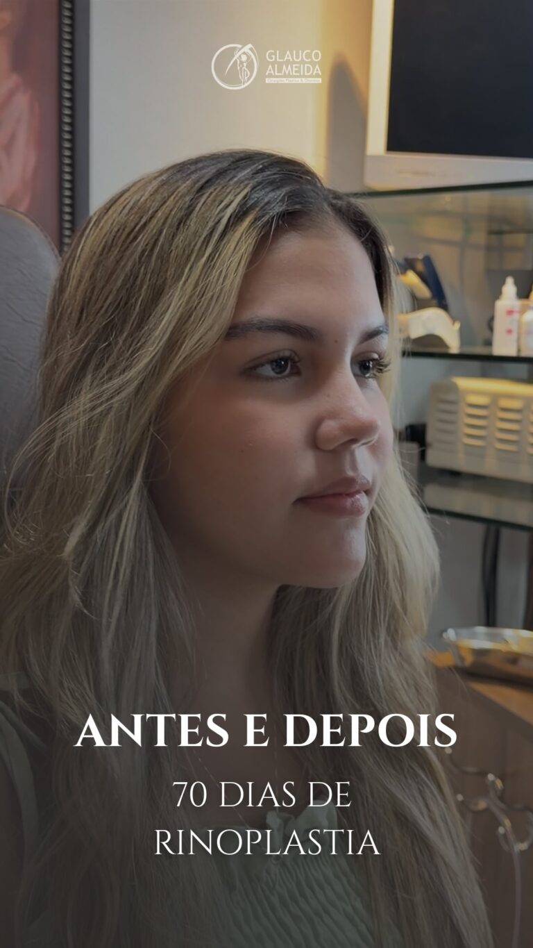 Instagram post from drglaucoalmeida. This post is in position 3.