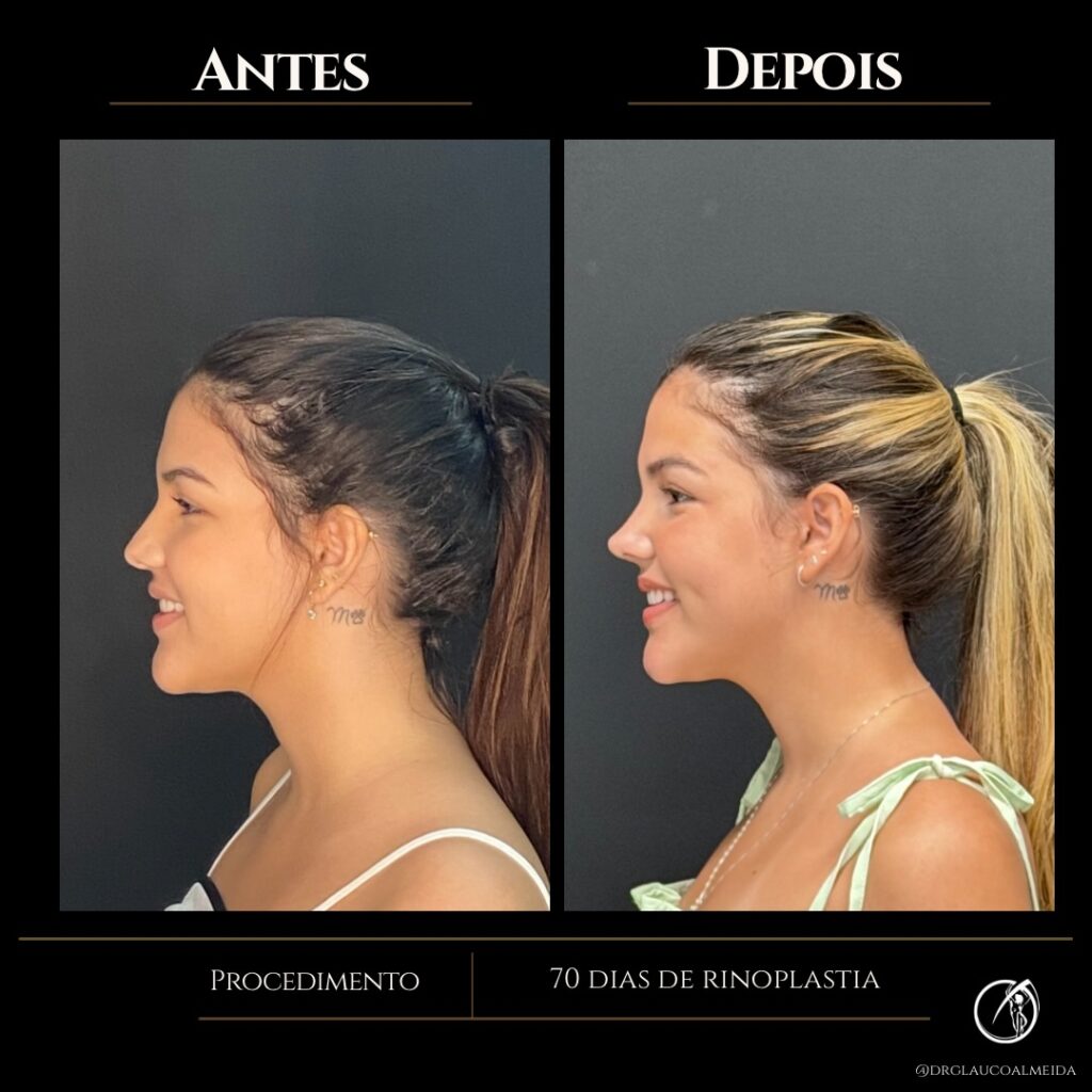 Instagram post from drglaucoalmeida. This post is in position 2.