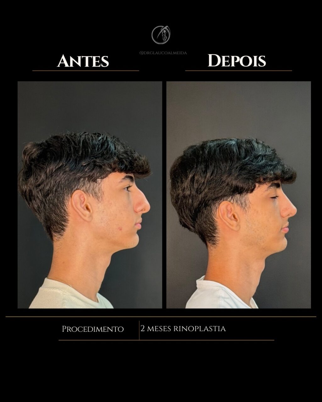 Instagram post from drglaucoalmeida. This post is in position 2.