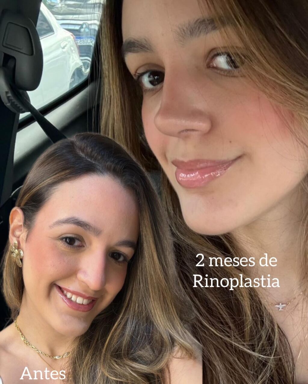 Instagram post from drglaucoalmeida. This post is in position 1.