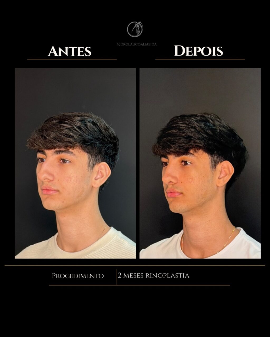 Instagram post from drglaucoalmeida. This post is in position 3.