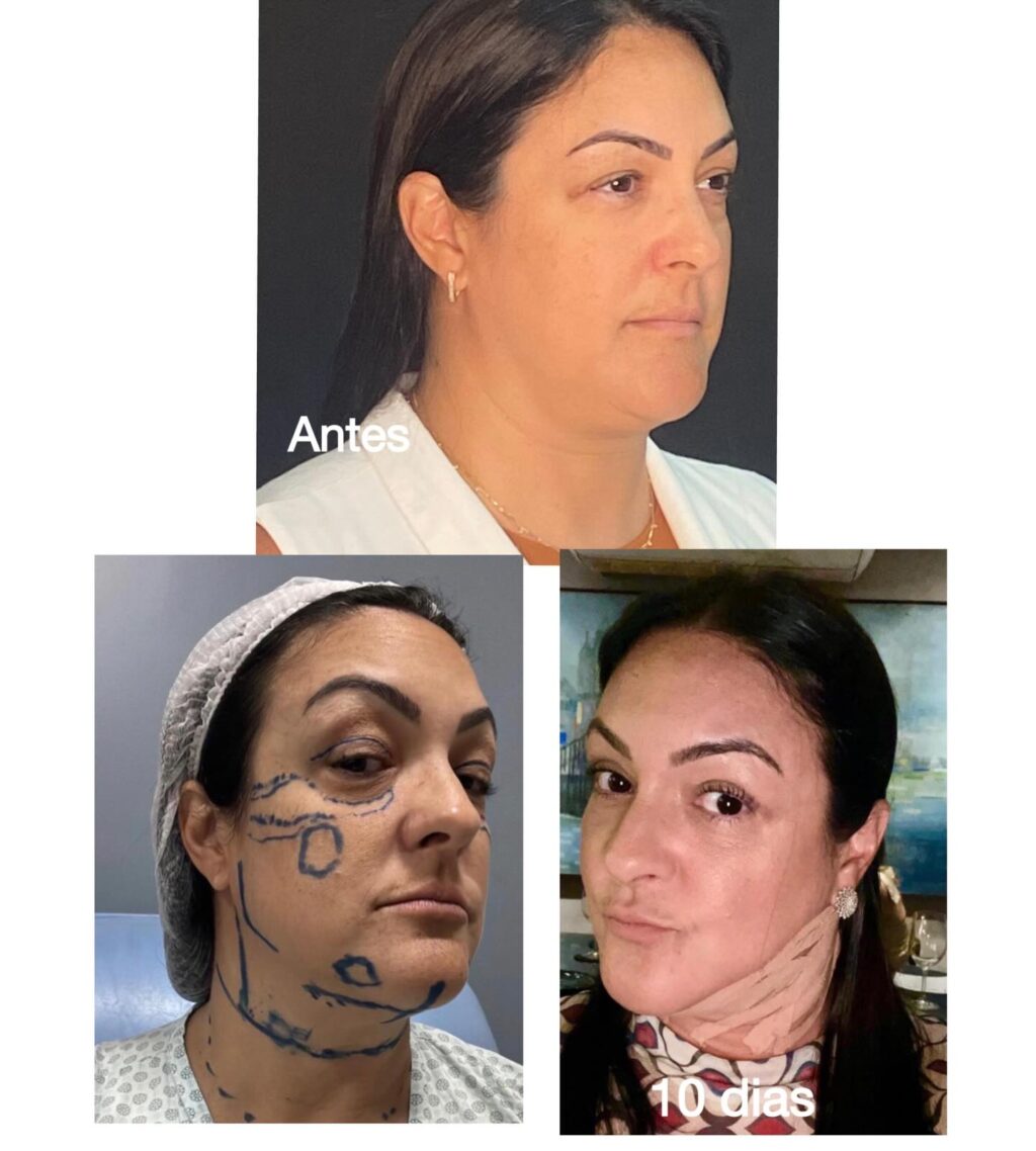 Instagram post from drglaucoalmeida. This post is in position 2.