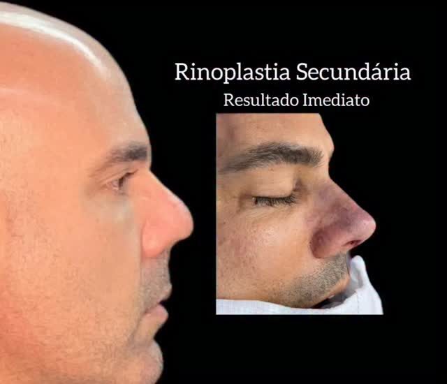 Instagram post from drglaucoalmeida. This post is in position 0.