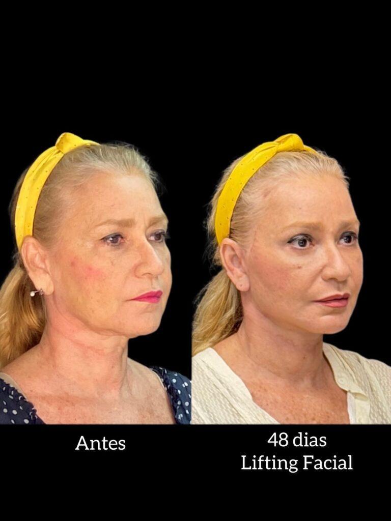 Instagram post from drglaucoalmeida. This post is in position 1.