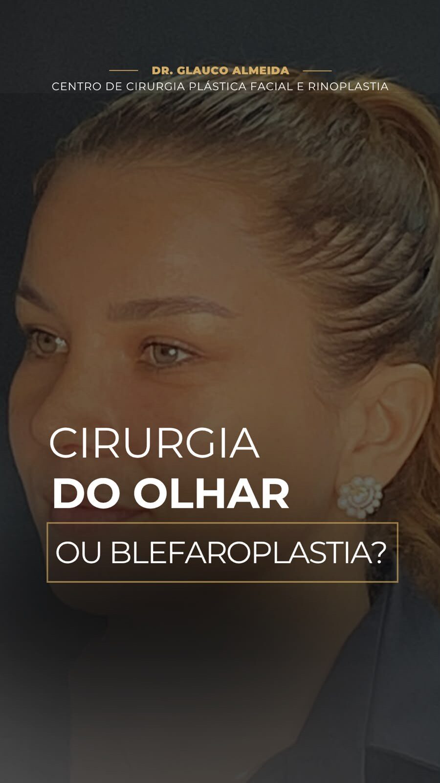 Instagram post from drglaucoalmeida. This post is in position 0.