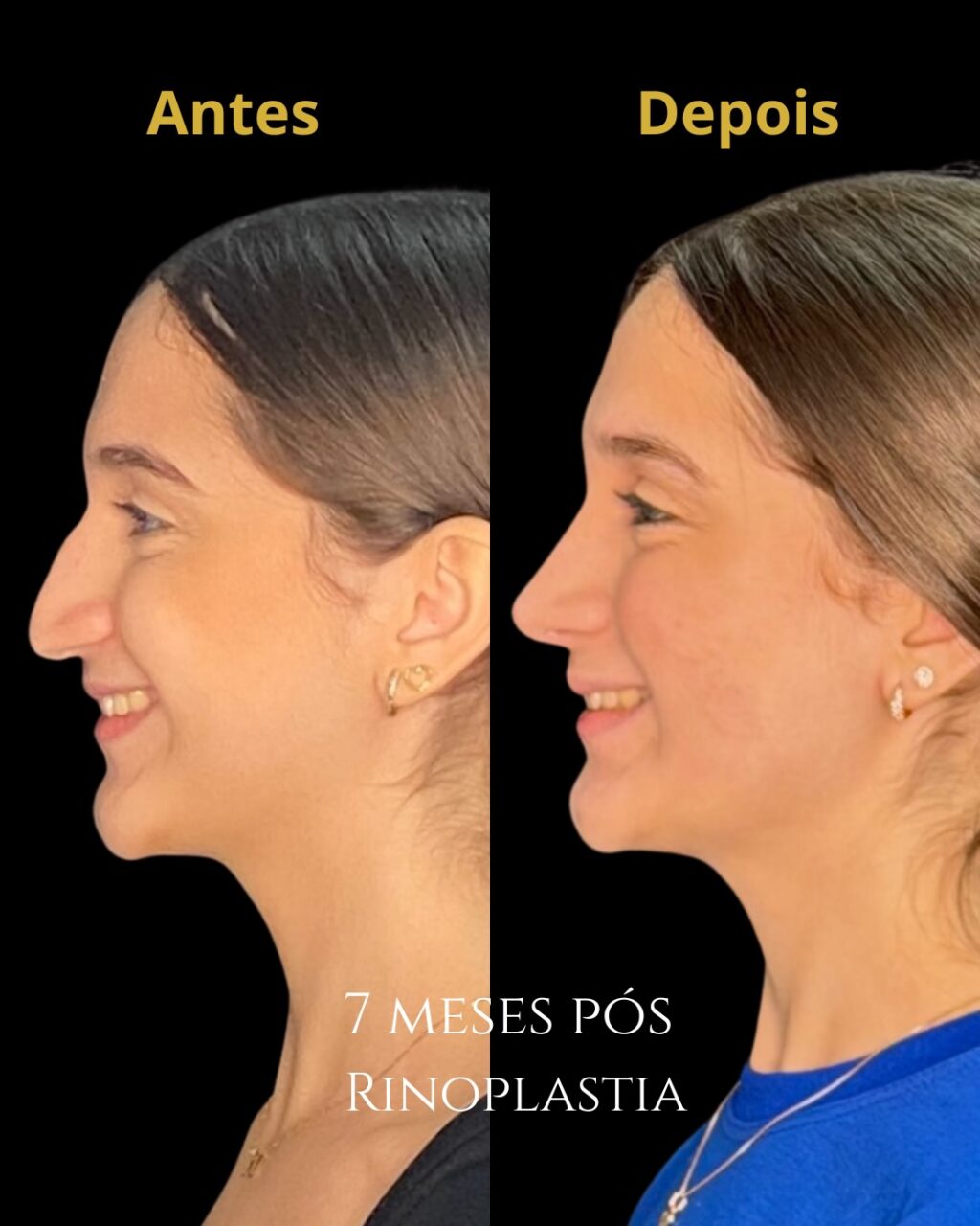 Instagram post from drglaucoalmeida. This post is in position 0.