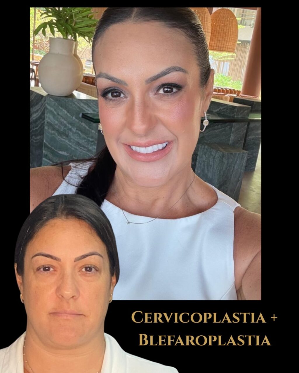 Instagram post from drglaucoalmeida. This post is in position 3.