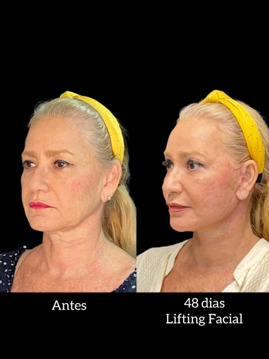 Instagram post from drglaucoalmeida. This post is in position 2.