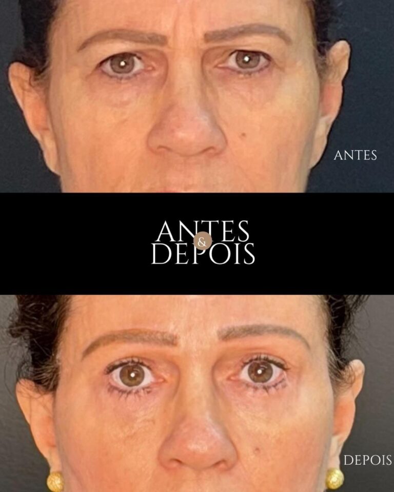 Instagram post from drglaucoalmeida. This post is in position 3.