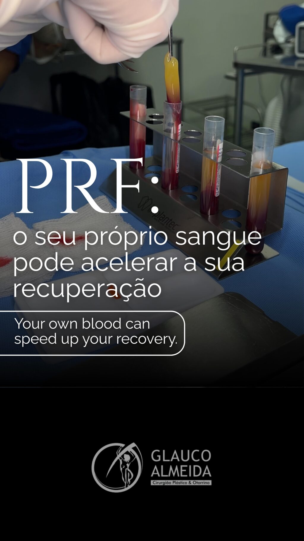 Instagram post from drglaucoalmeida. This post is in position 3.