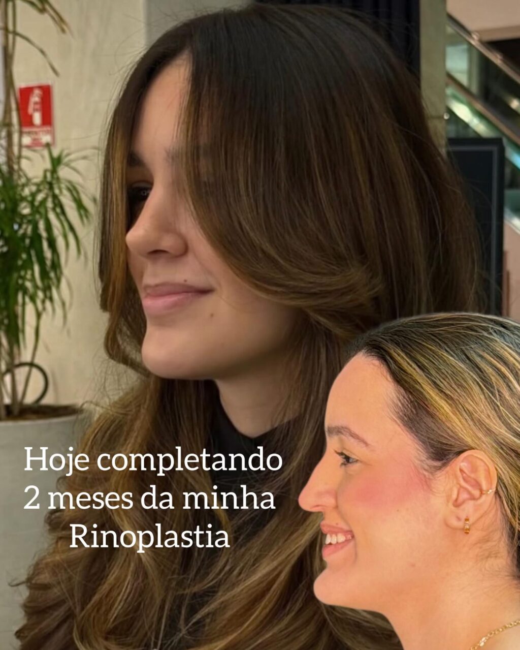 Instagram post from drglaucoalmeida. This post is in position 0.