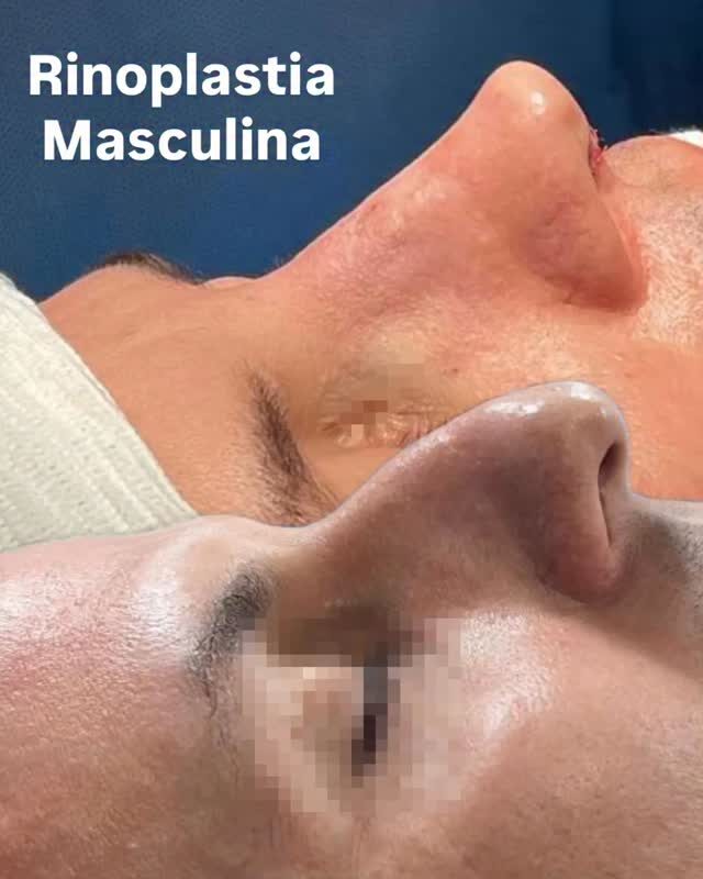 Instagram post from drglaucoalmeida. This post is in position 2.