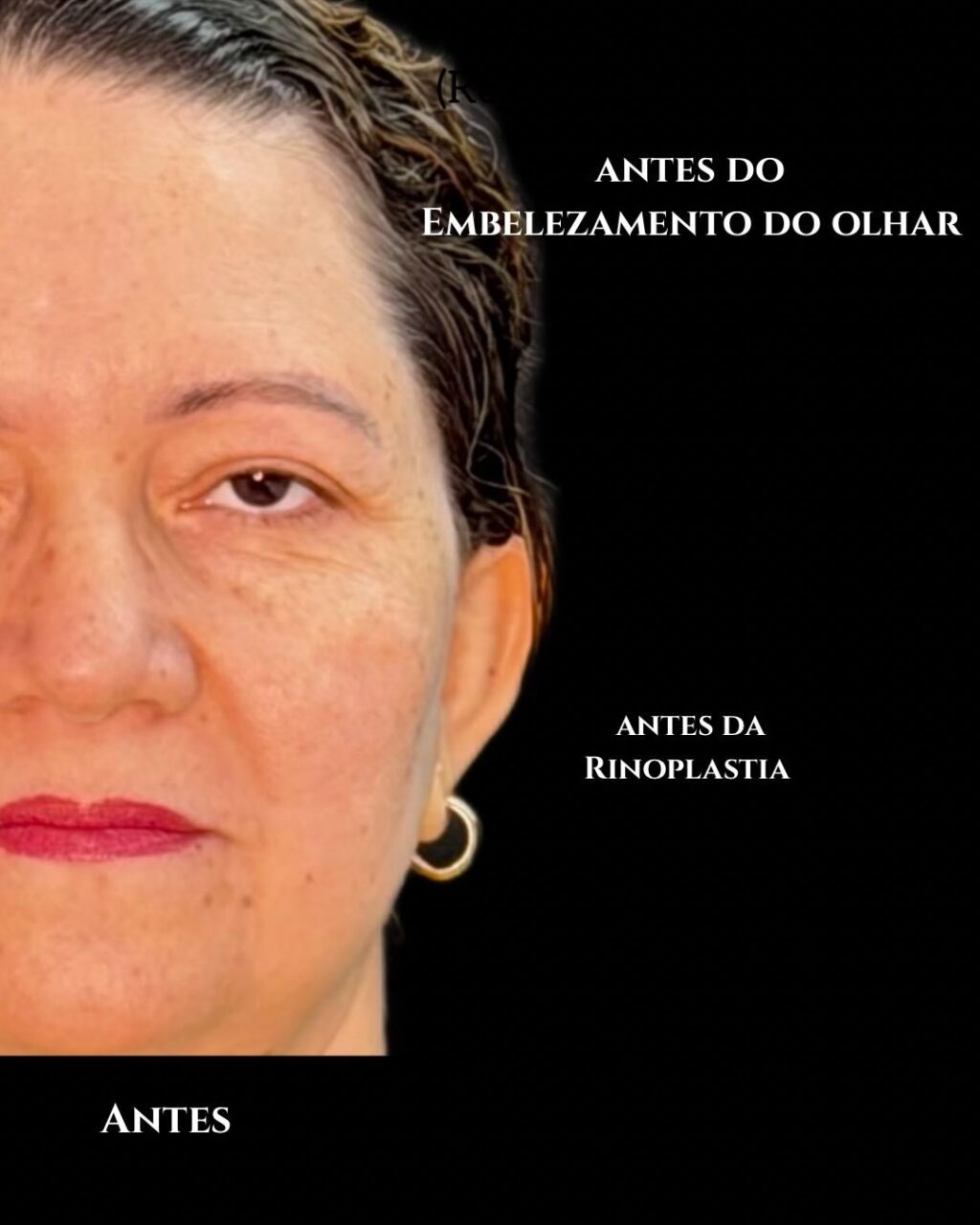 Instagram post from drglaucoalmeida. This post is in position 1.