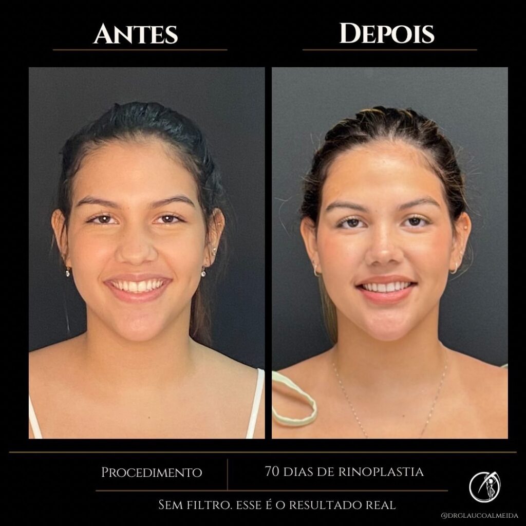 Instagram post from drglaucoalmeida. This post is in position 0.