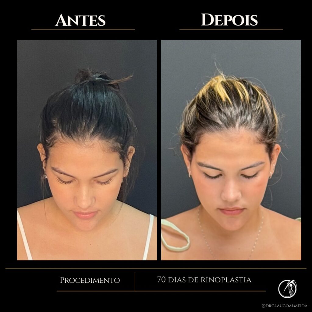 Instagram post from drglaucoalmeida. This post is in position 4.