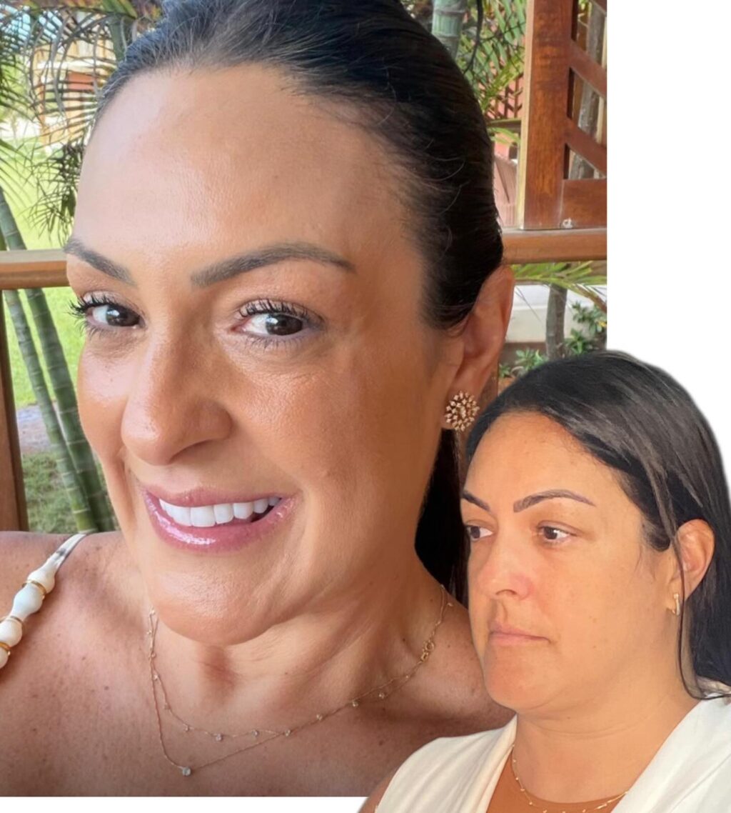 Instagram post from drglaucoalmeida. This post is in position 5.