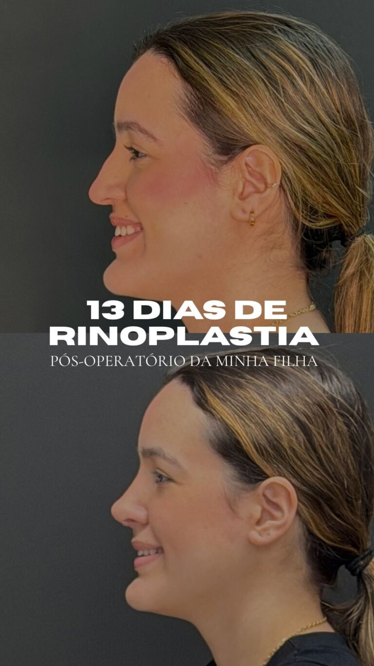 Instagram post from drglaucoalmeida. This post is in position 4.