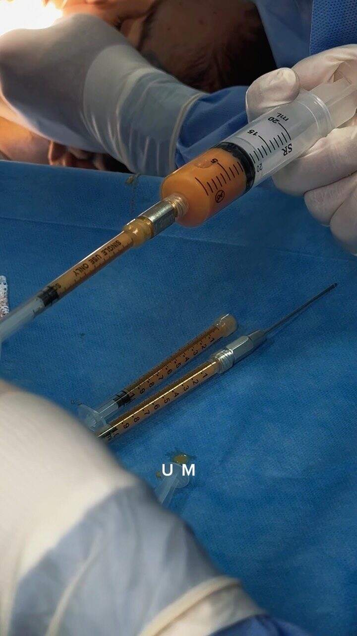 Instagram post from drglaucoalmeida. This post is in position 1.