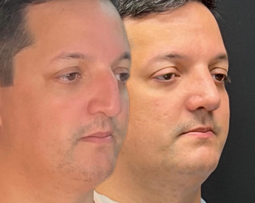 Instagram post from drglaucoalmeida. This post is in position 3.