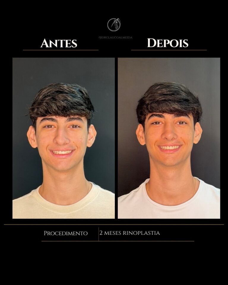 Instagram post from drglaucoalmeida. This post is in position 1.