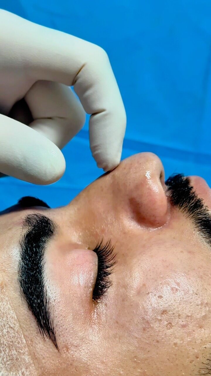 Instagram post from drglaucoalmeida. This post is in position 1.