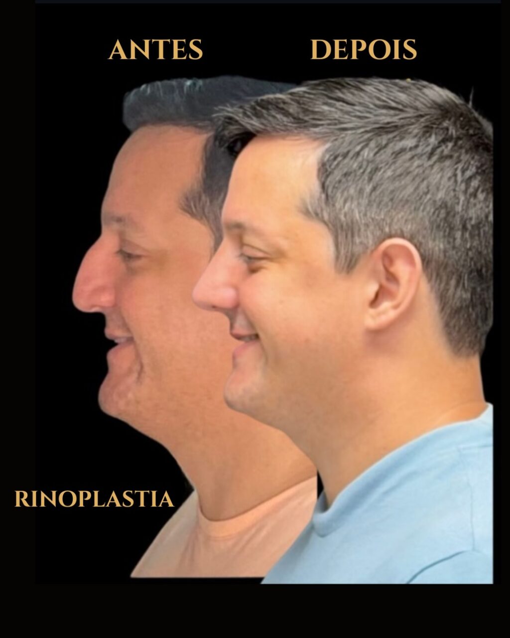 Instagram post from drglaucoalmeida. This post is in position 3.