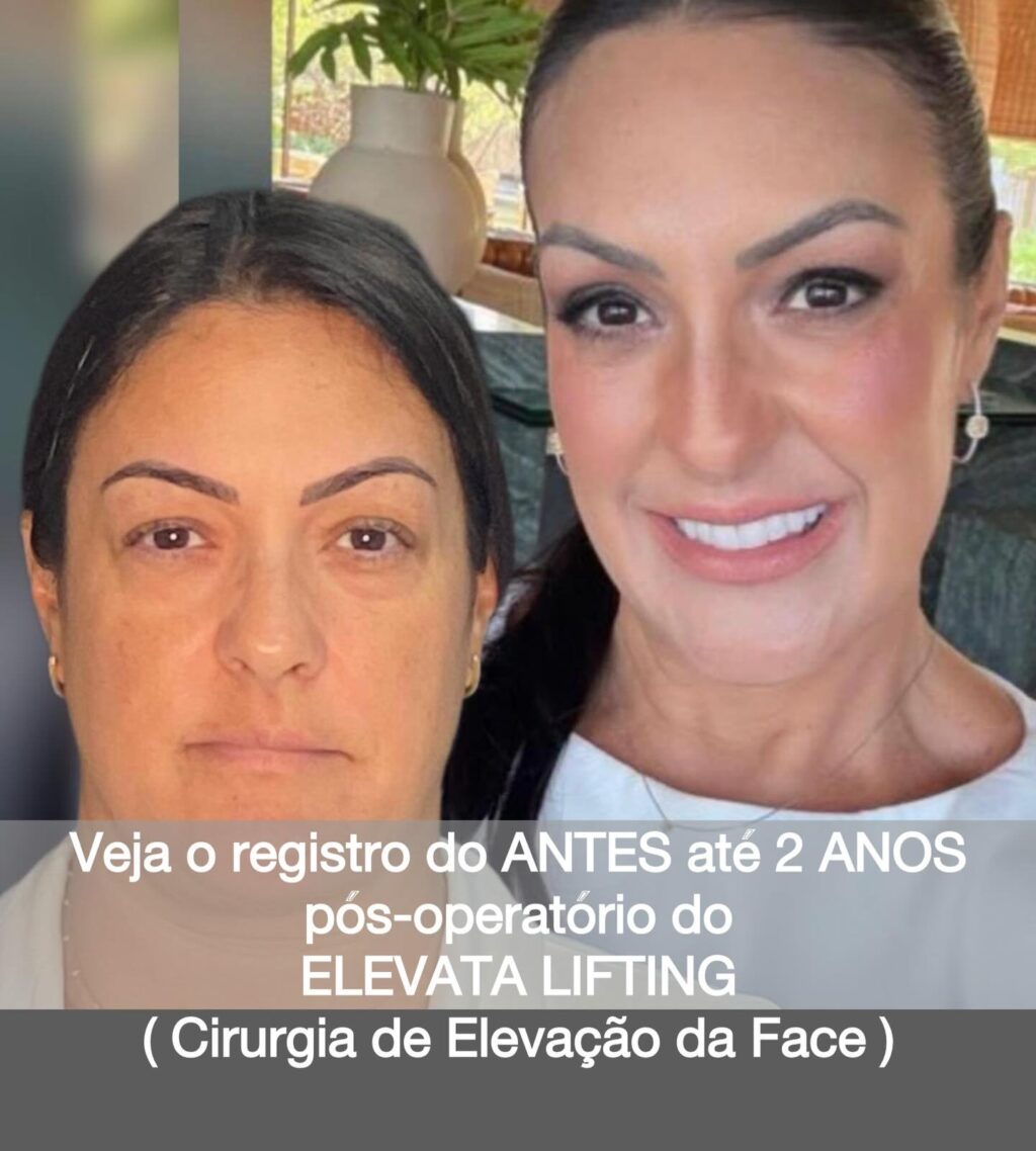 Instagram post from drglaucoalmeida. This post is in position 0.