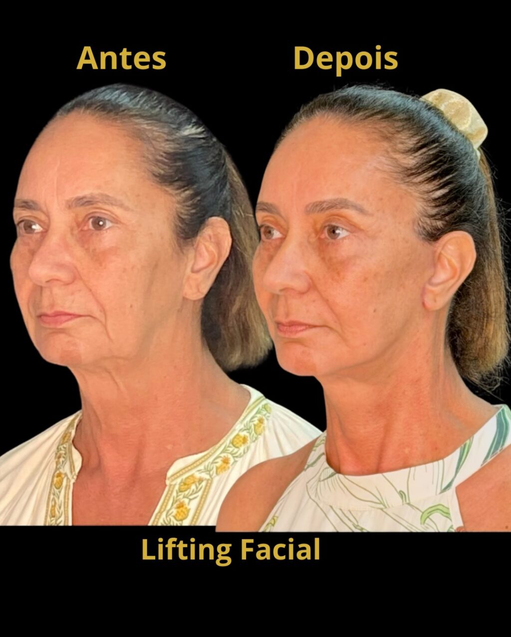 Instagram post from drglaucoalmeida. This post is in position 7.