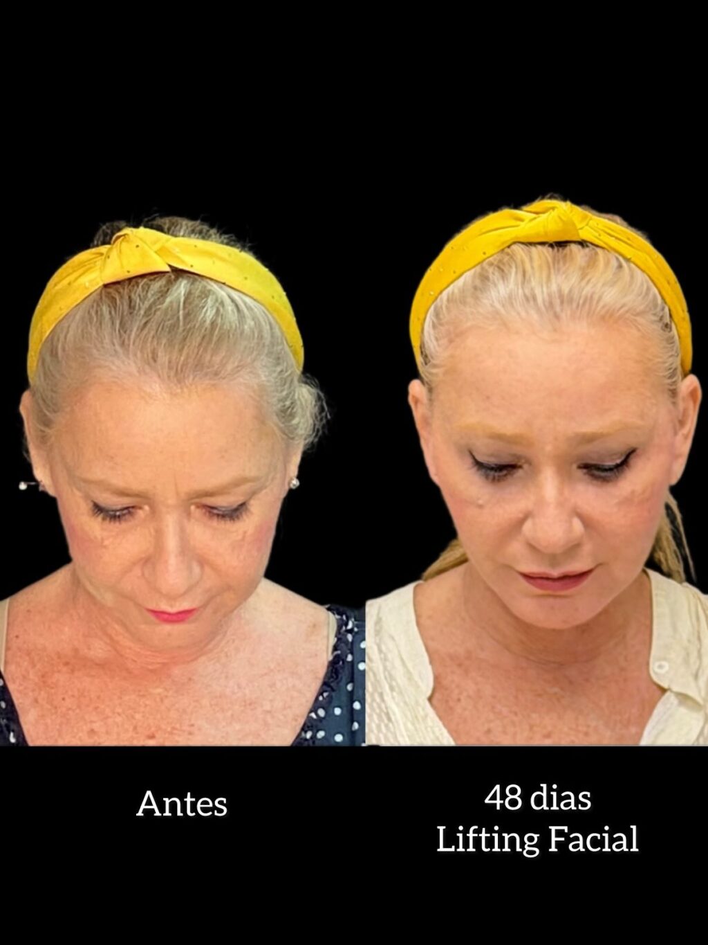 Instagram post from drglaucoalmeida. This post is in position 5.