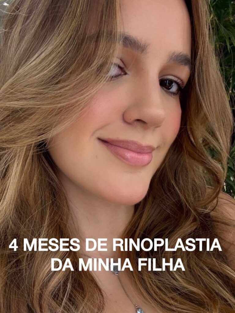 Instagram post from drglaucoalmeida. This post is in position 1.