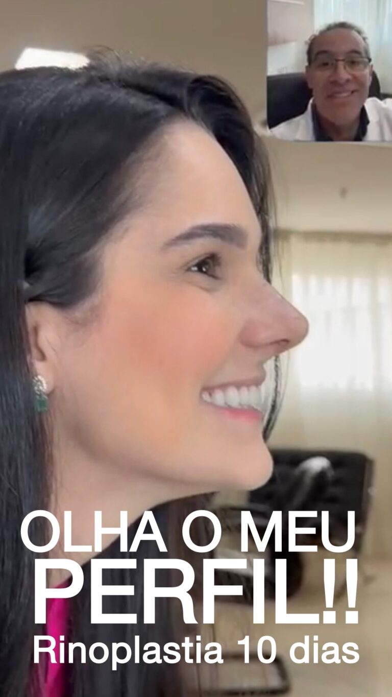 Instagram post from drglaucoalmeida. This post is in position 3.