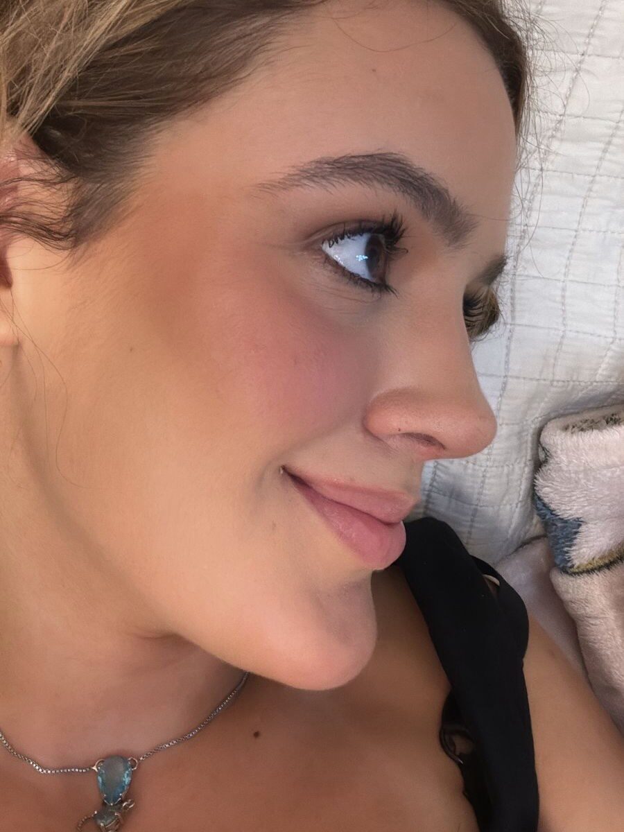 Instagram post from drglaucoalmeida. This post is in position 4.