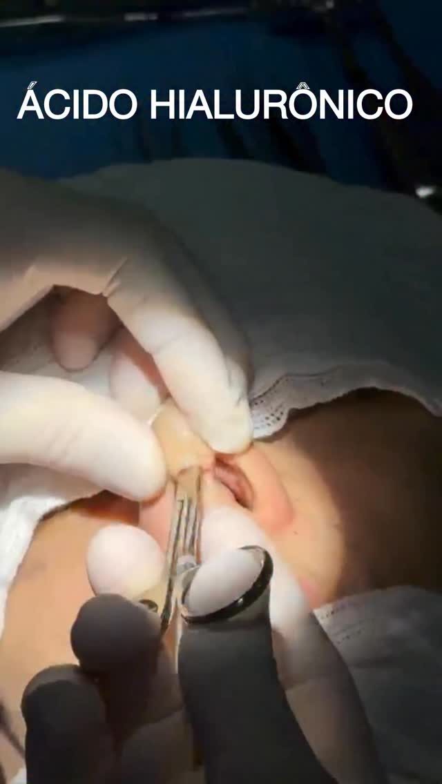 Instagram post from drglaucoalmeida. This post is in position 1.
