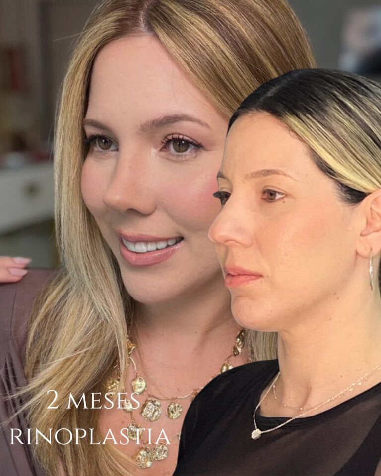 Instagram post from drglaucoalmeida. This post is in position 1.