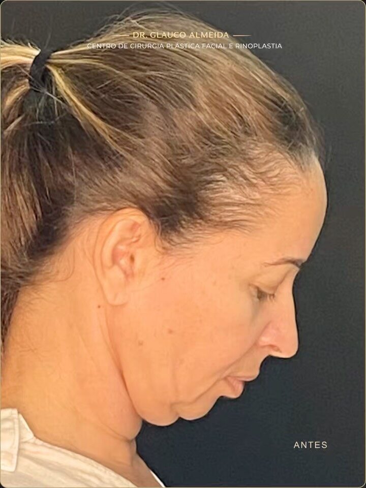 Instagram post from drglaucoalmeida. This post is in position 2.