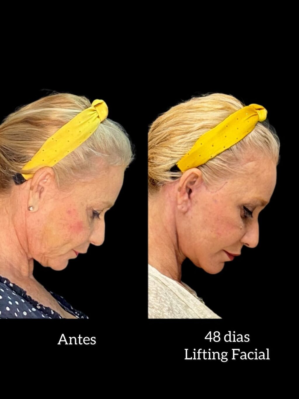 Instagram post from drglaucoalmeida. This post is in position 1.