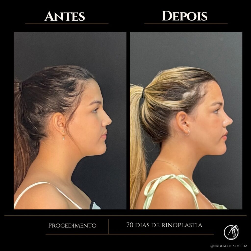 Instagram post from drglaucoalmeida. This post is in position 3.