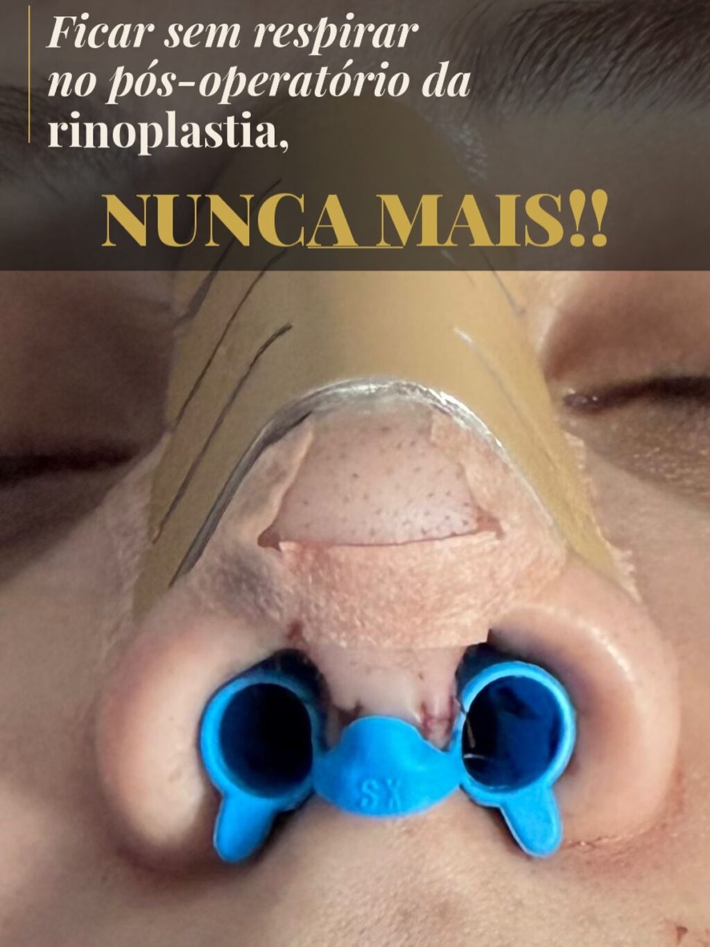 Instagram post from drglaucoalmeida. This post is in position 0.